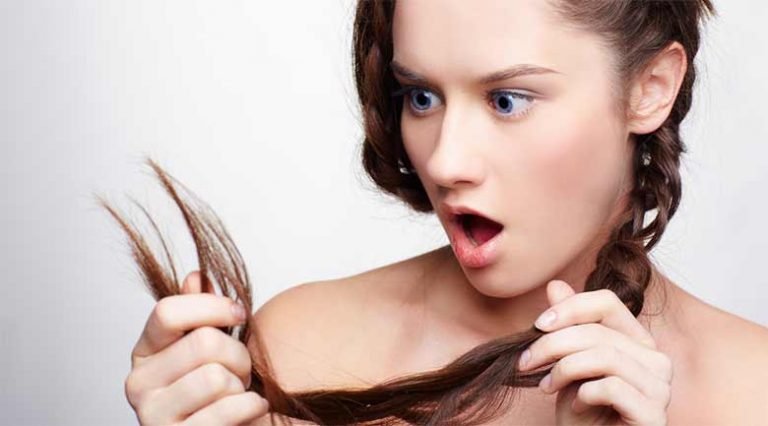 biotina-perdida-cabello