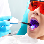 Evolución y Avances en las Luces de Fotocurado para Odontología