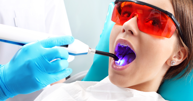 luces-fotocurado dental2